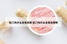 肛門(mén)為什么會(huì)有白斑 肛門(mén)為什么會(huì)有白斑呢