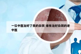 一位中醫(yī)治好了我的白斑 誰有治好白斑的老中醫(yī)