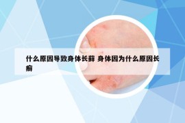 什么原因?qū)е律眢w長蘚 身體因為什么原因長癬