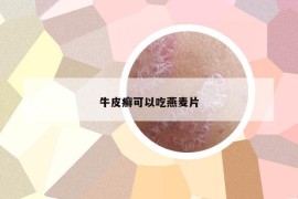 牛皮癬可以吃燕麥片