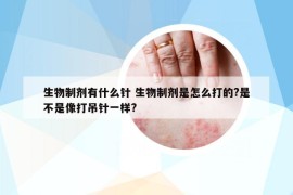 生物制劑有什么針 生物制劑是怎么打的?是不是像打吊針一樣?