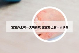 寶寶身上有一大塊白斑 寶寶身上有一小塊白