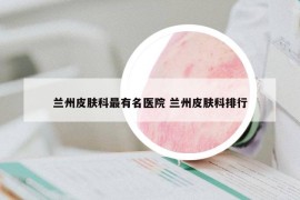 蘭州皮膚科最有名醫(yī)院 蘭州皮膚科排行