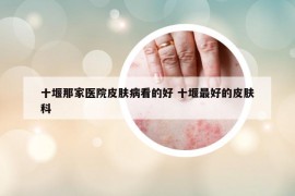 十堰那家醫(yī)院皮膚病看的好 十堰最好的皮膚科