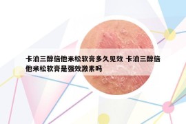 卡泊三醇倍他米松軟膏多久見效 卡泊三醇倍他米松軟膏是強(qiáng)效激素嗎