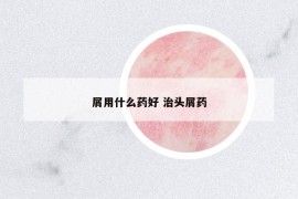 屑用什么藥好 治頭屑藥