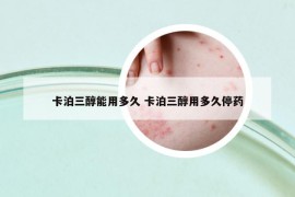 卡泊三醇能用多久 卡泊三醇用多久停藥