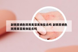 副銀屑病色斑用美容美體能去嗎 副銀屑病色斑用美容美體能去嗎