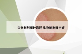 生物制劑哪種最好 生物制劑哪個好