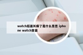 watch后面長癬了是什么意思 iphone watch背面