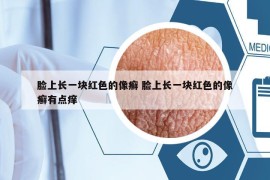 臉上長一塊紅色的像癬 臉上長一塊紅色的像癬有點(diǎn)癢