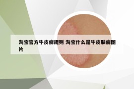 淘寶官方牛皮癬規(guī)則 淘寶什么是牛皮膚癬圖片