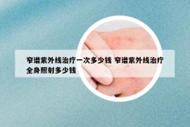 窄譜紫外線治療一次多少錢(qián) 窄譜紫外線治療全身照射多少錢(qián)