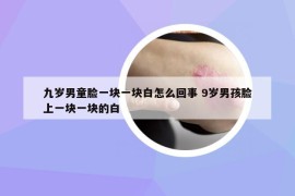 九歲男童臉一塊一塊白怎么回事 9歲男孩臉上一塊一塊的白