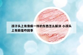 孩子頭上有像癬一樣的東西怎么解決 小孩頭上有蘚是咋回事