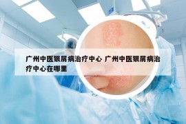 廣州中醫(yī)銀屑病治療中心 廣州中醫(yī)銀屑病治療中心在哪里