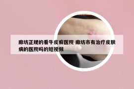 廊坊正規(guī)的看牛皮癬醫(yī)院 廊坊市有治療皮膚病的醫(yī)院嗎的短視頻