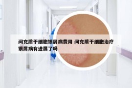 間充質(zhì)干細(xì)胞銀屑病費用 間充質(zhì)干細(xì)胞治療銀屑病有進(jìn)展了嗎