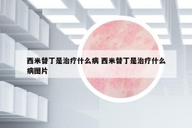 西米替丁是治療什么病 西米替丁是治療什么病圖片