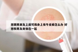 想跟男朋友上床可我身上有牛皮癬怎么辦 好想和男友身體在一起