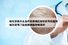 哈爾濱有什么治療皮膚病比較好的專科醫(yī)院 哈爾濱專門治皮膚病醫(yī)院哪家好