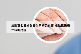 皮膚莫名其妙張類似于癬的東西 皮膚起像癬一樣的疙瘩