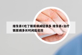 維生素C吃了銀屑病減輕很多 維生素c治療銀屑病多長(zhǎng)時(shí)間能見(jiàn)效