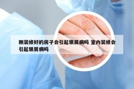 剛裝修好的房子會引起銀屑病嗎 室內(nèi)裝修會引起銀屑病嗎