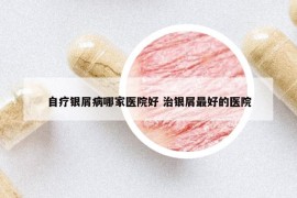 自療銀屑病哪家醫(yī)院好 治銀屑最好的醫(yī)院