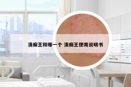 清癬王和哪一個 清癬王使用說明書