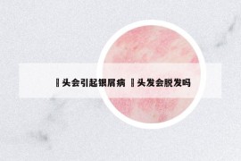 焗頭會引起銀屑病 焗頭發(fā)會脫發(fā)嗎