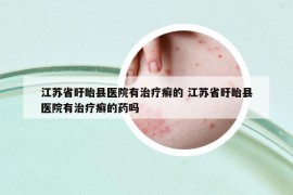 江蘇省盱眙縣醫(yī)院有治療癬的 江蘇省盱眙縣醫(yī)院有治療癬的藥嗎