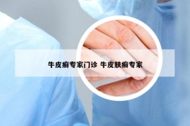 牛皮癬專家門診 牛皮膚癬專家