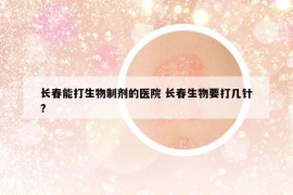 長(zhǎng)春能打生物制劑的醫(yī)院 長(zhǎng)春生物要打幾針?