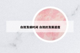 白斑發(fā)病時(shí)間 白斑的發(fā)展速度