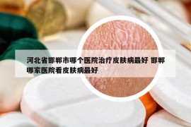 河北省邯鄲市哪個(gè)醫(yī)院治療皮膚病最好 邯鄲哪家醫(yī)院看皮膚病最好