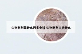 生物制劑是什么藥多少錢(qián) 生物制劑主治什么