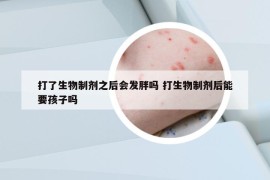 打了生物制劑之后會(huì)發(fā)胖嗎 打生物制劑后能要孩子嗎