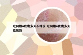 吃阿維a膠囊多久不掉皮 吃阿維a膠囊多久能見(jiàn)效
