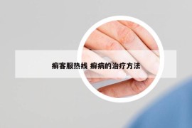 癬客服熱線 癬病的治療方法