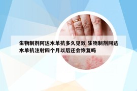 生物制劑阿達(dá)木單抗多久見(jiàn)效 生物制劑阿達(dá)木單抗注射四個(gè)月以后還會(huì)恢復(fù)嗎