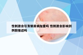 性刺激會(huì)引發(fā)銀屑病加重嗎 性刺激會(huì)影響到例假推遲嗎