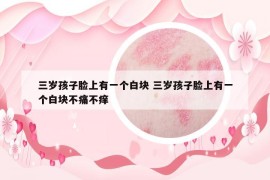 三歲孩子臉上有一個白塊 三歲孩子臉上有一個白塊不痛不癢