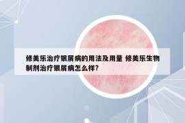 修美樂治療銀屑病的用法及用量 修美樂生物制劑治療銀屑病怎么樣?