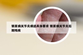 銀屑病關(guān)節(jié)炎病退具體要求 銀屑病關(guān)節(jié)炎后期殘疾