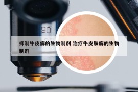 抑制牛皮癬的生物制劑 治療牛皮膚癬的生物制劑