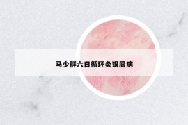 馬少群六日循環(huán)灸銀屑病