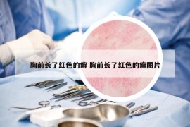 胸前長(zhǎng)了紅色的癬 胸前長(zhǎng)了紅色的癬圖片