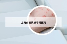 上海白癜風病?？漆t(yī)院