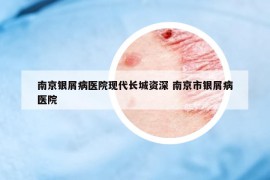 南京銀屑病醫(yī)院現(xiàn)代長(zhǎng)城資深 南京市銀屑病醫(yī)院